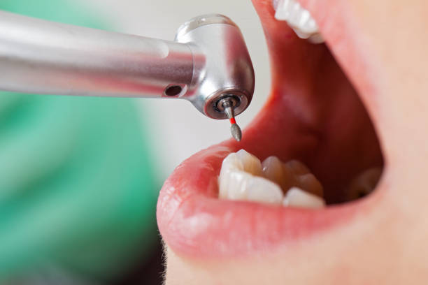 Best Emergency Gum Treatment in Warsaw, KY